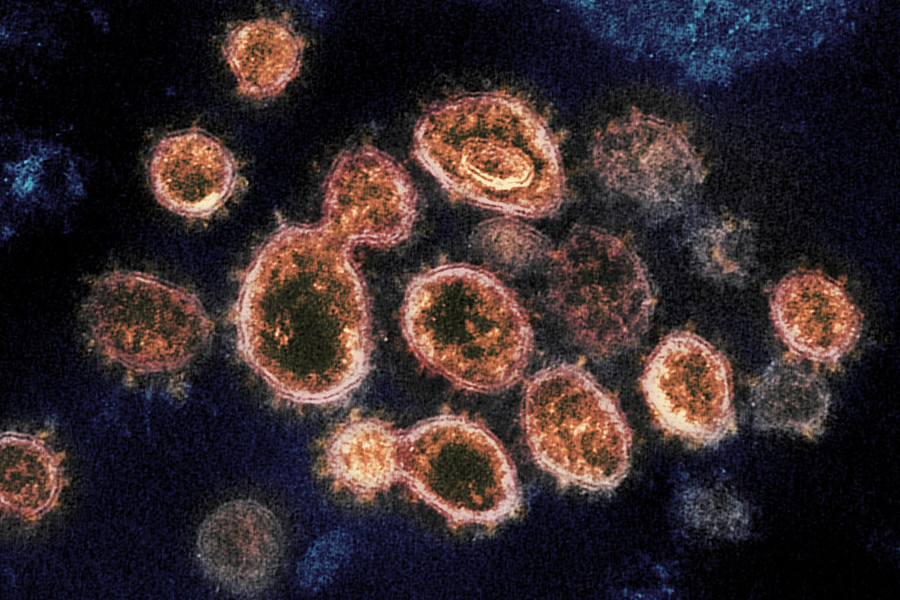 Coronavirus in the U.S. -- Should We Be Worried?
